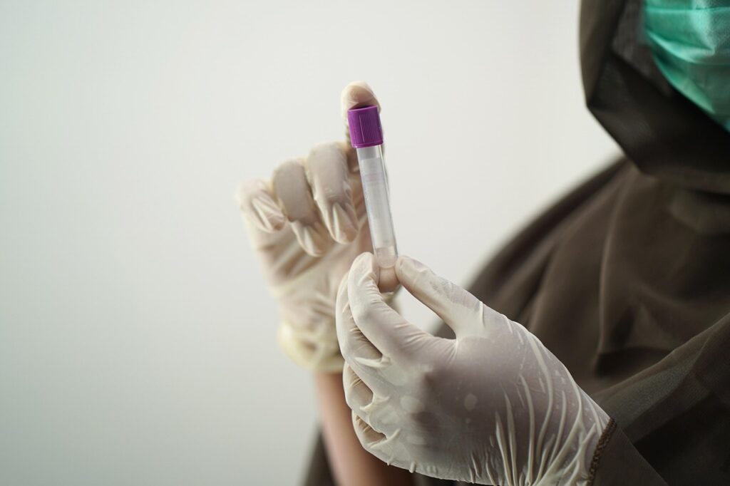 Lab technician in gloves handling a blood sample for testing