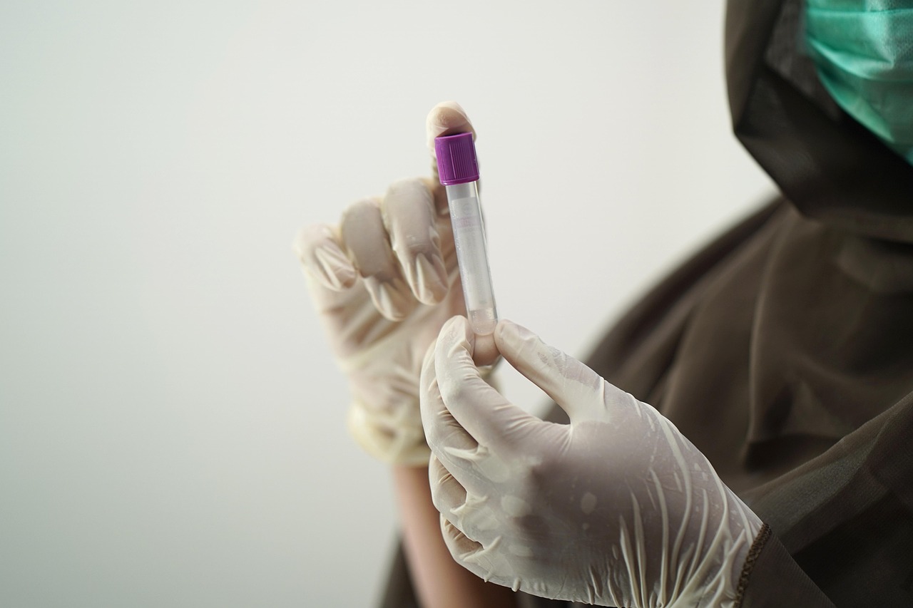 Lab technician in gloves handling a blood sample for testing